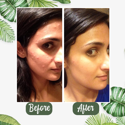 🔥Final Sale - Green Tea Deep Cleanse Mask (🔥LAST DAY SALE-80% OFF)