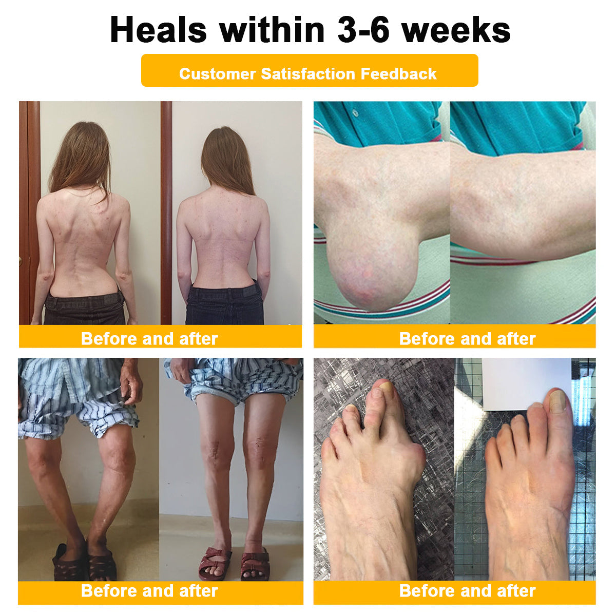 LOVILDS™ Botulinum Toxin & Bee Venom Pain-Relief Bone Healing Cream (7️⃣Day Quick Results)