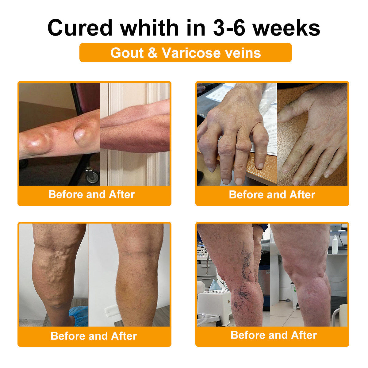 LOVILDS™ Botulinum Toxin & Bee Venom Pain-Relief Bone Healing Cream (7️⃣Day Quick Results)