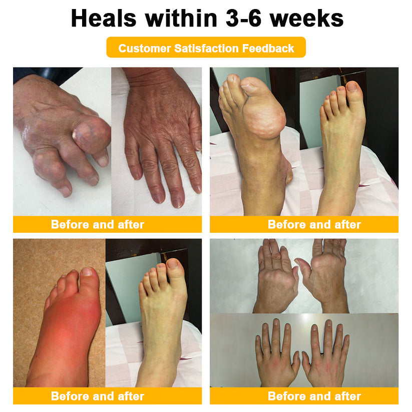 LOVILDS™ Botulinum Toxin & Bee Venom Pain-Relief Bone Healing Cream (7️⃣Day Quick Results)
