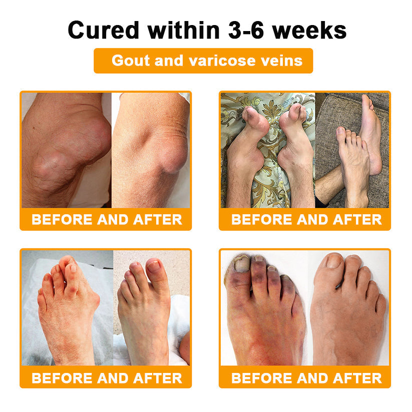 LOVILDS™ Botulinum Toxin & Bee Venom Pain-Relief Bone Healing Cream (7️⃣Day Quick Results)
