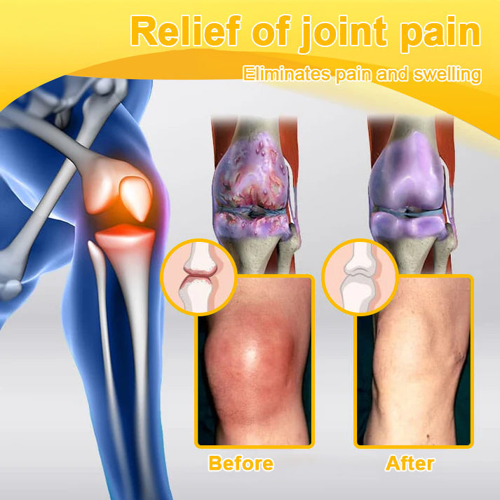 LOVILDS™ Botulinum Toxin & Bee Venom Pain-Relief Bone Healing Cream (7️⃣Day Quick Results)