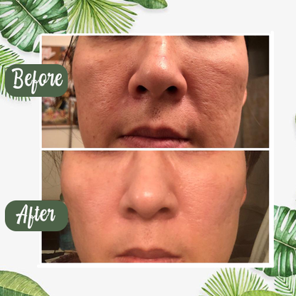 🔥Final Sale - Green Tea Deep Cleanse Mask （🔥LAST DAY SALE-80% OFF)