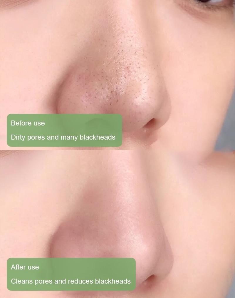 🔥Final Sale - Green Tea Deep Cleanse Mask （🔥LAST DAY SALE-80% OFF)
