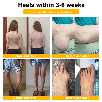 LOVILDS™ Botulinum Toxin & Bee Venom Pain-Relief Bone Healing Cream (7️⃣Day Quick Results)