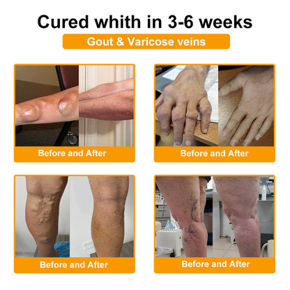 LOVILDS™ Botulinum Toxin & Bee Venom Pain-Relief Bone Healing Cream (7️⃣Day Quick Results)